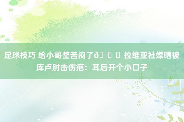 足球技巧 给小哥整苦闷了😅拉维亚社媒晒被库卢肘击伤疤：耳后开个小口子